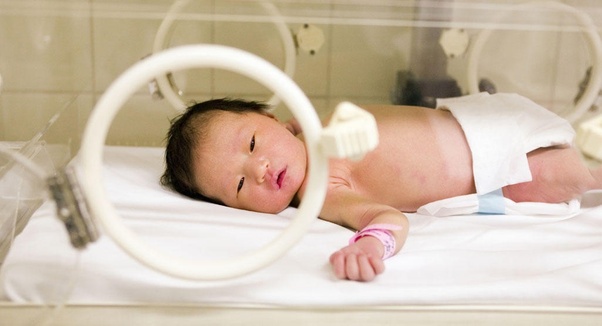 Reasons Why Your Baby Might Be Admitted in the NICU