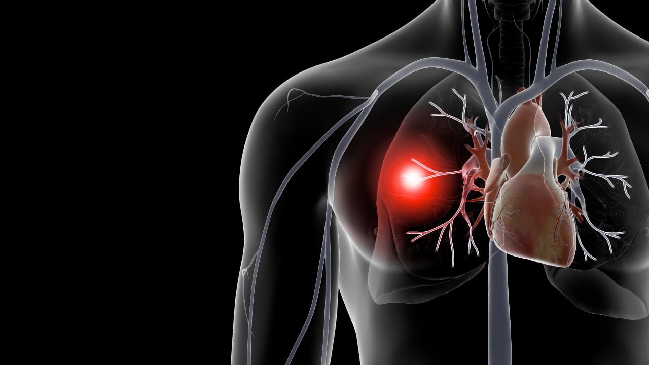 Pulmonary Treatment Basics: How to Breathe Better
