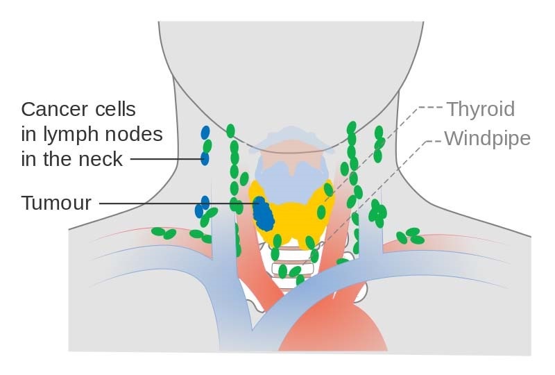 Thyroid Problems Symptoms