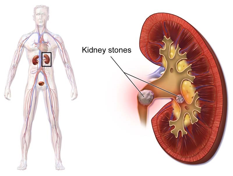 10 Symptom’s Of Kidney Disease