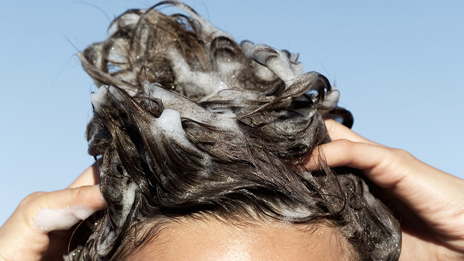 How often should I wash my hair if I have dandruff?