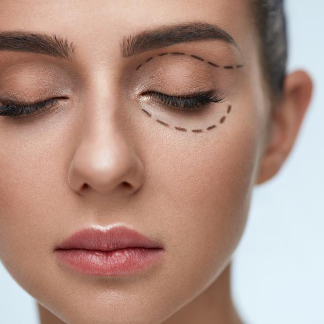 Want No sagging and No circles. Have an Enhancing Eye Lift in Dubai