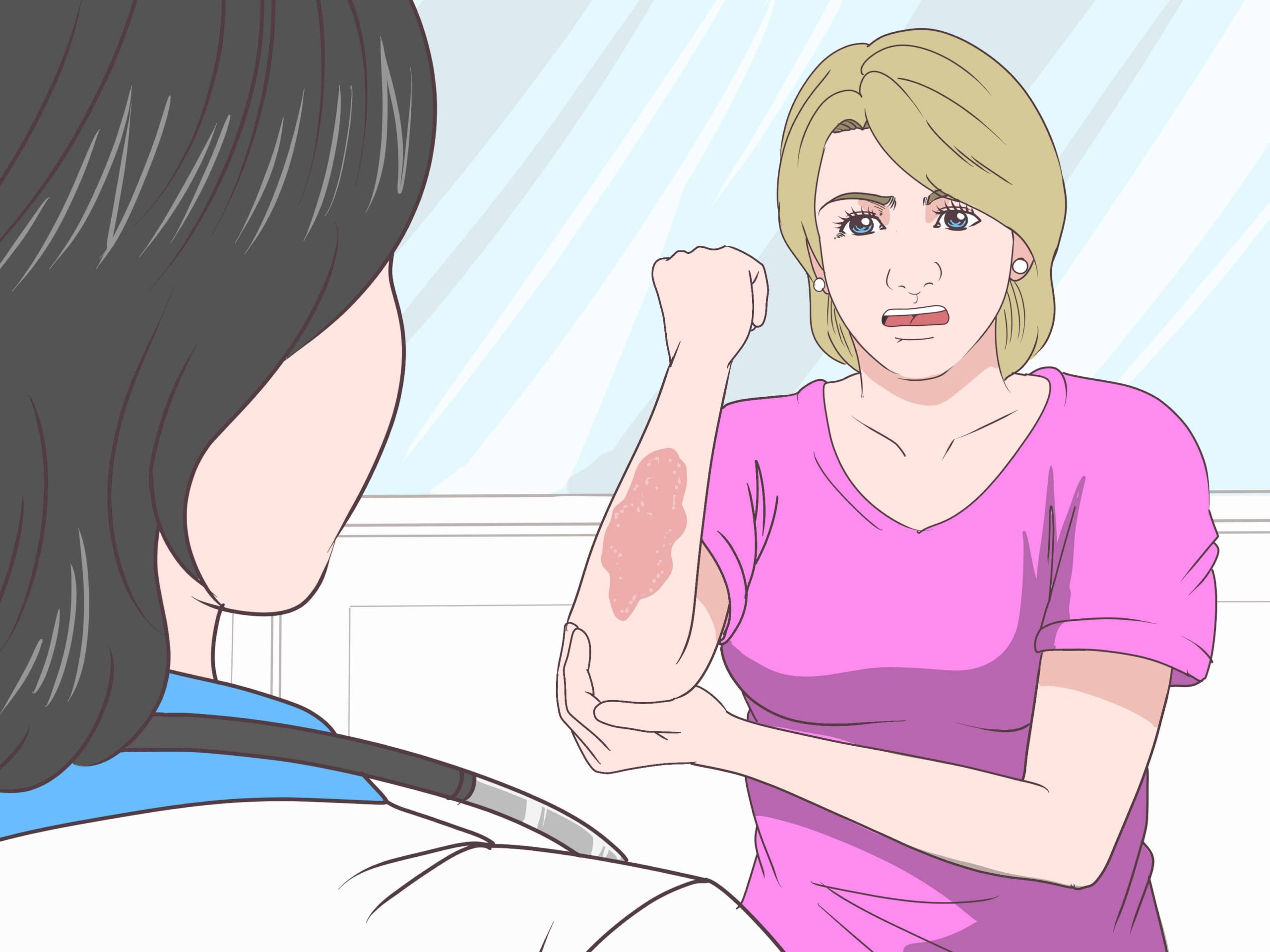 How To Respond To Burns And Scalds